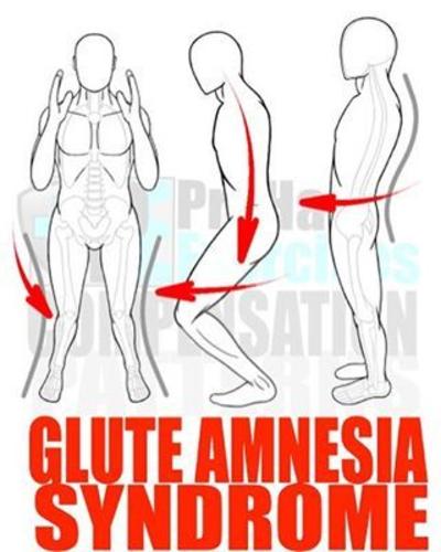 Dawn Shepard  Glute Amnesia. Yes, it is a Real Thing.